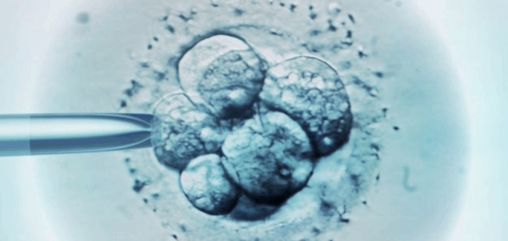 frozen embryo transfer