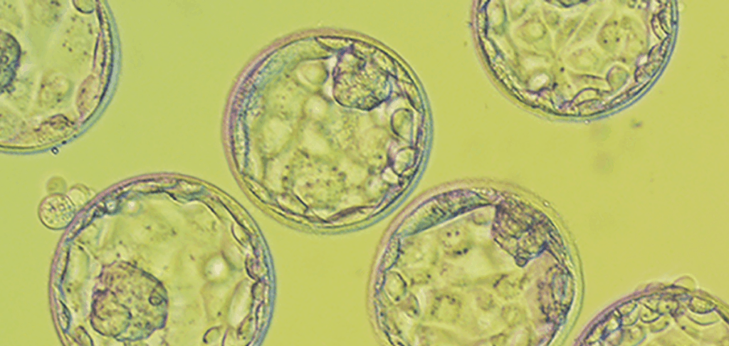 blastocyst culture