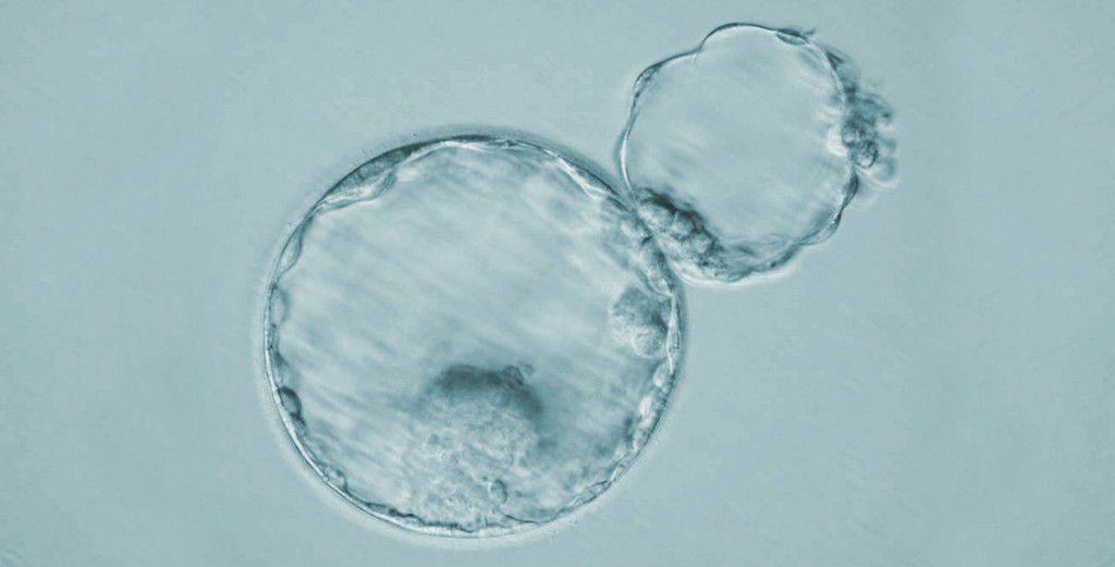 assisted hatching services