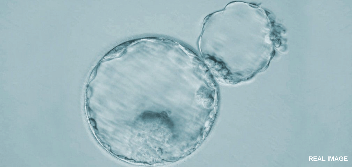 assisted hatching services